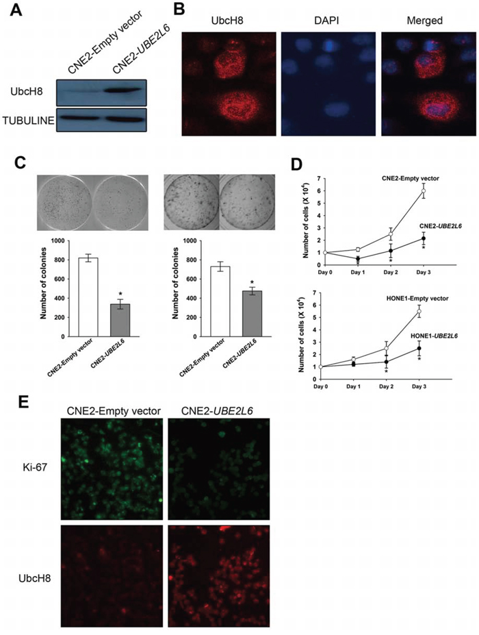 Ectopic expression of UBE2L6 in NPC cells inhibits colony formation and proliferation.