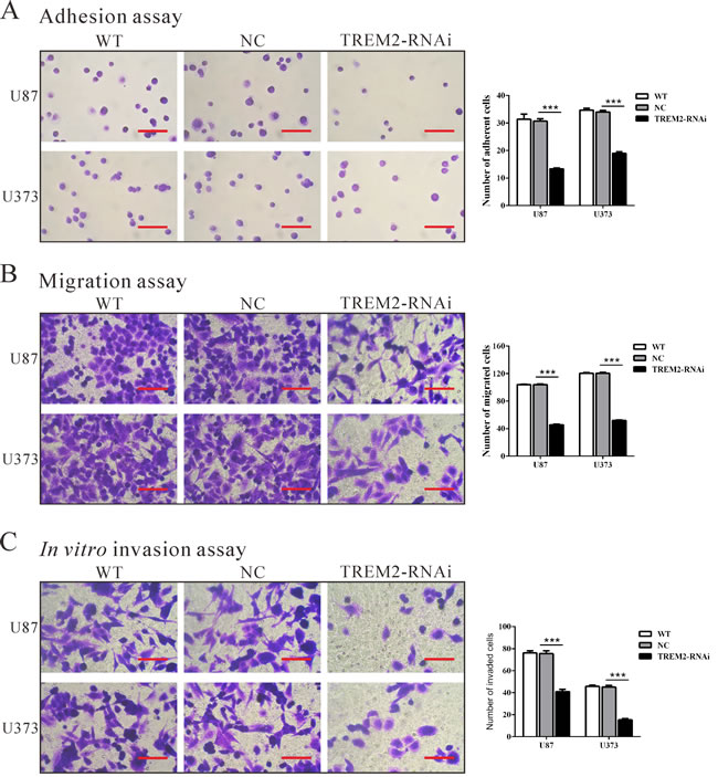Silencing of TREM2 inhibited cell adhesion, migration and invasion in glioma cells.