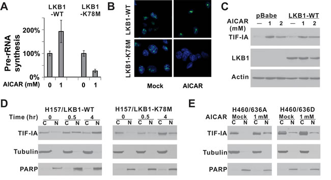 LKB1 kinase activity is required for the nuclear accumulation of TIF-IA after AICAR treatment.