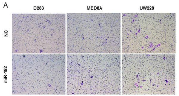 miR-192 and epithelial-mesenchymal transition (EMT).