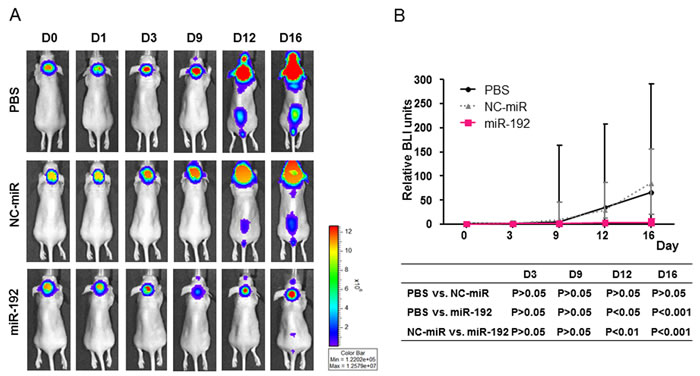 Therapeutic effect of miR-192 and inhibition of tumor seeding