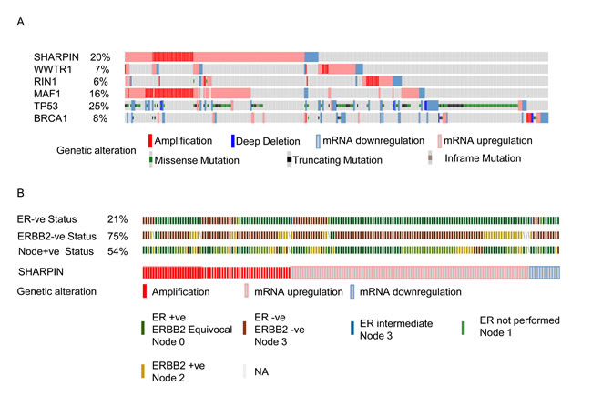 cBioportal analysis showing distinct genetic alteration in candidate genes in BC patients.