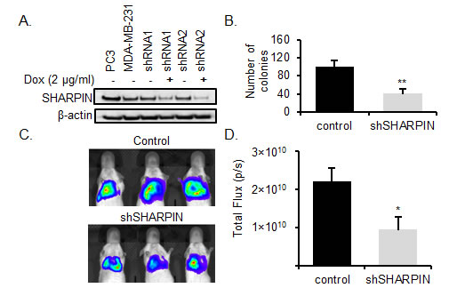 SHARPIN knockdown inhibits BC metastasis.