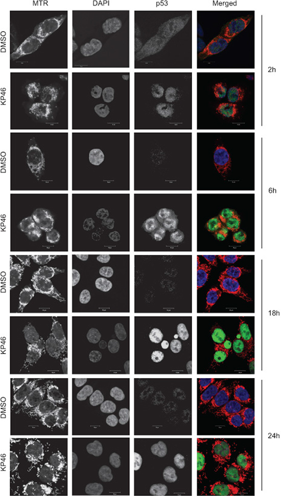 p53 is upregulated in the nucleus.