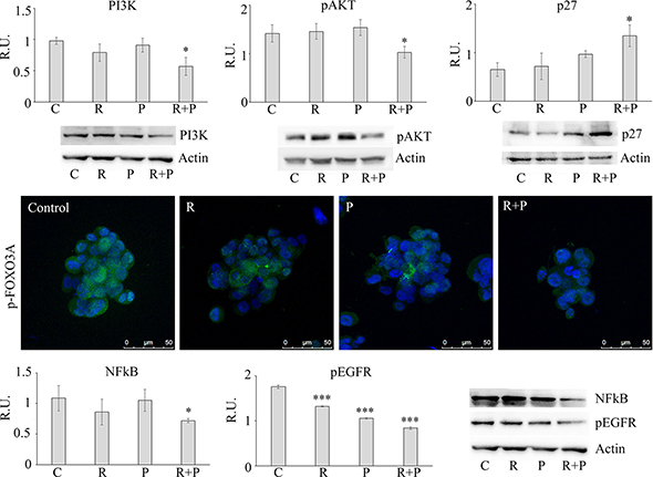 Representative western blotting and relative densitometric analysis, expressed as relative units, for PI3K, p-AKT, p27, NFKB, p-EGFR in control and treated mammospheres.