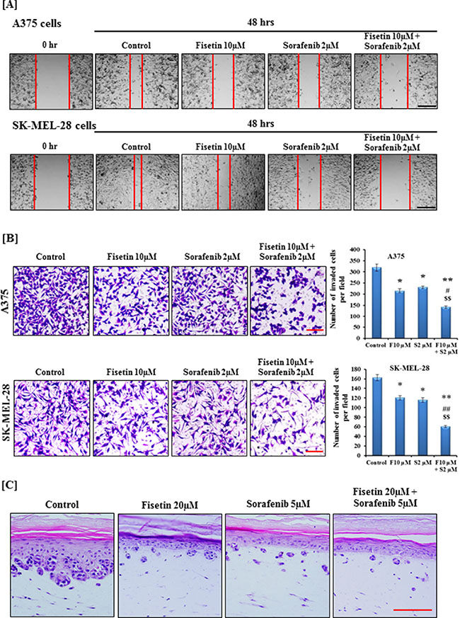 Effect of fisetin, sorafenib and their combination on migration and invasion of BRAF-mutated melanoma cells.