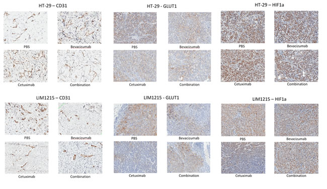 Expression of CD31, GLUT-1 and HIF1-alpha following treatment.