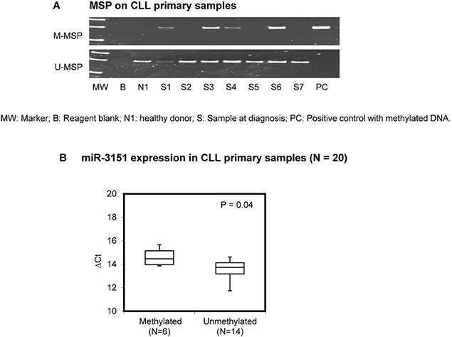 Methylation of miR-3151 in primary samples.