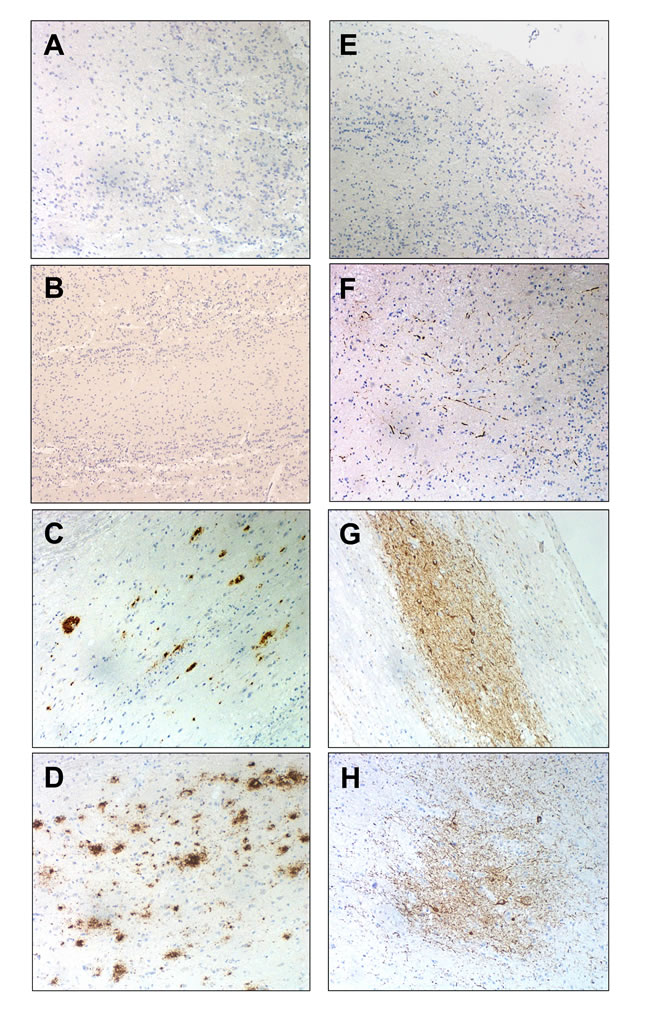 Representative immunohistochemical analysis of Beta-amyloid and p-Tau in OB.