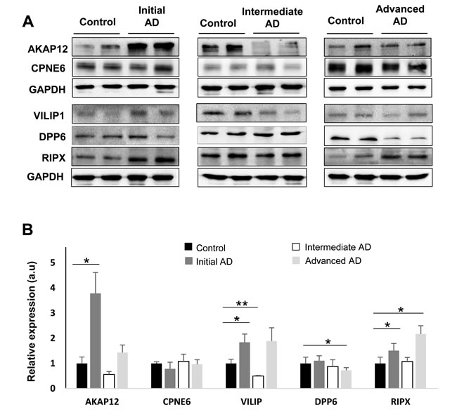 Olfactory bulb protein expression of