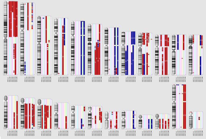 CNV analysis on metastatic KIT-mutated GIST.