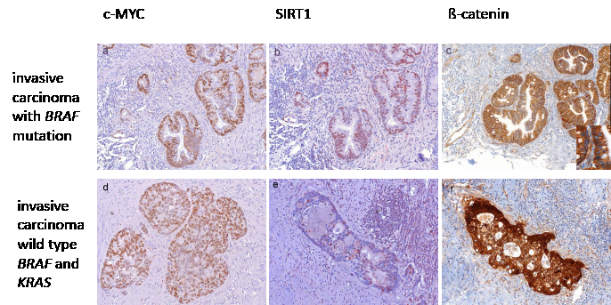 Expression of c-MYC and SIRT1 in correlation with beta-catenin localization.