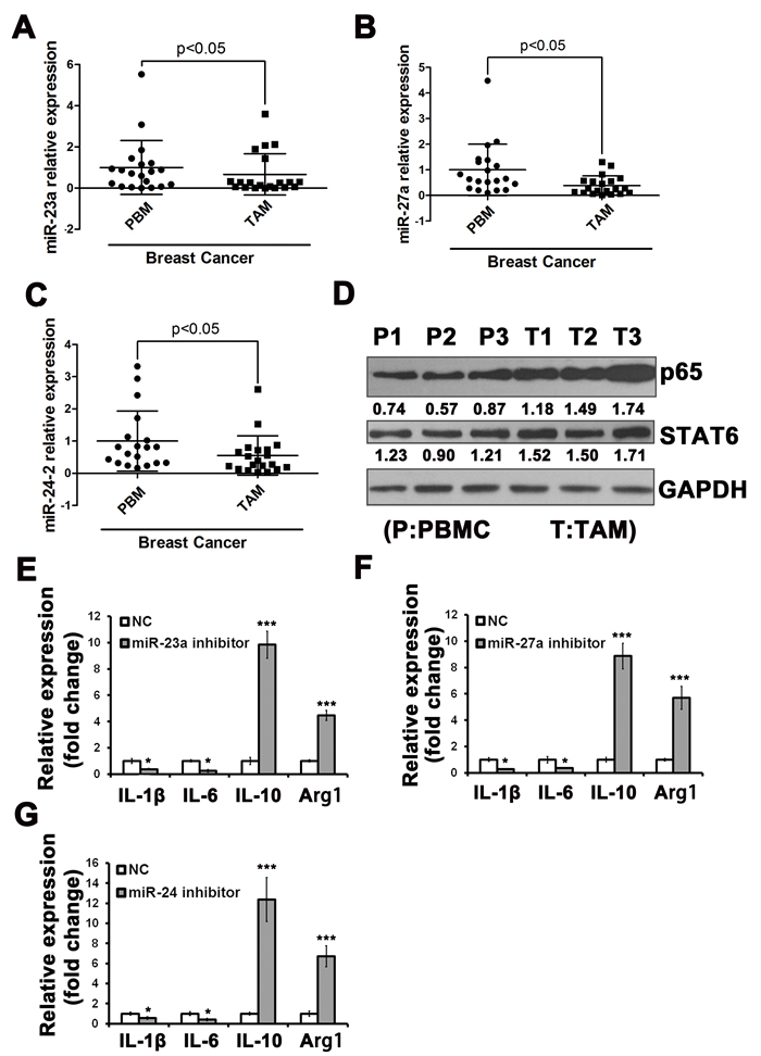 The miR-23a/27a/24-2 cluster was down-regulated in TAMs in breast cancer patients.