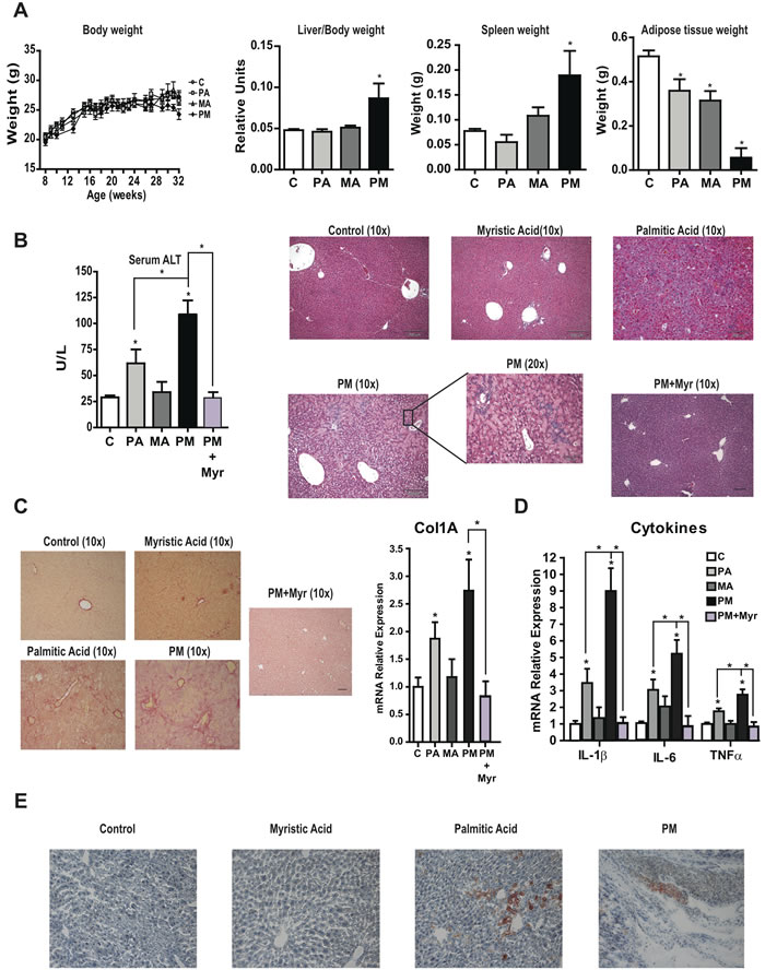 Chronic consumption of diets enriched in PA plus MA leads to lipodystrophy and progressive liver disease and effect of myriocin therapy.