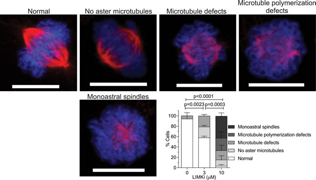 LIMK inhibition affects microtubule assembly in mitotic spindles.