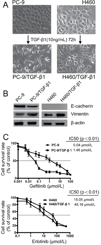 Effect of TGF-&#x03B2;1 on EMT and the sensitivity to gefitinib and erlotinib in EGFR-TKIs-resistant cells.