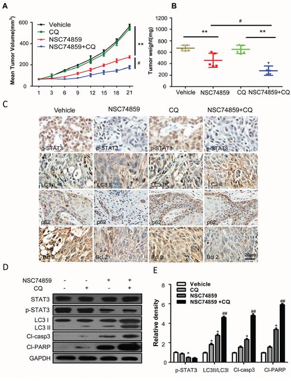 Targeting autophagy and STAT3 signaling blocks tumor growth in vivo.