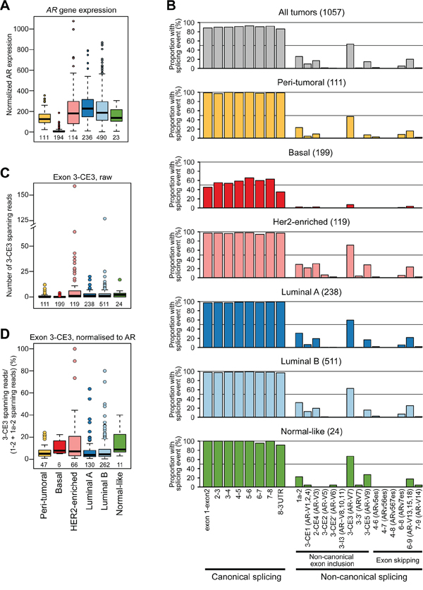 The diversity and frequency of AR splicing in breast cancer.