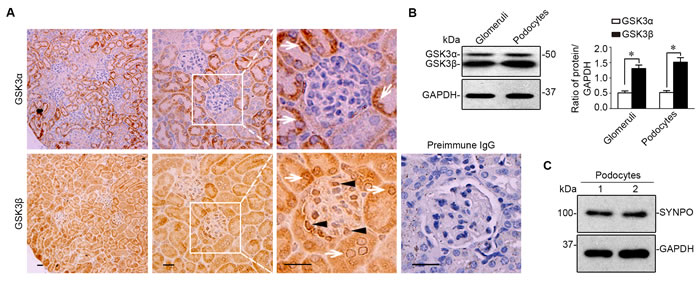 The &#x3b2; instead of the &#x3b1; isoform of GSK3 is predominantly expressed in glomeruli and mainly located to podocytes in mouse kidneys.