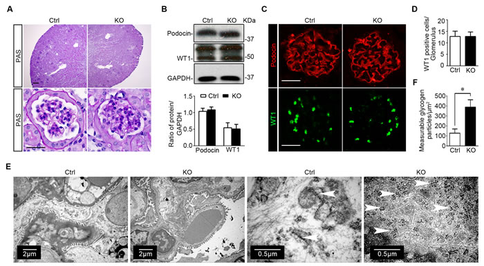Specific ablation of GSK3&#x3b2; in mature glomerular podocytes does not affect kidney histology except an increase of glycogen accumulation in podocytes.