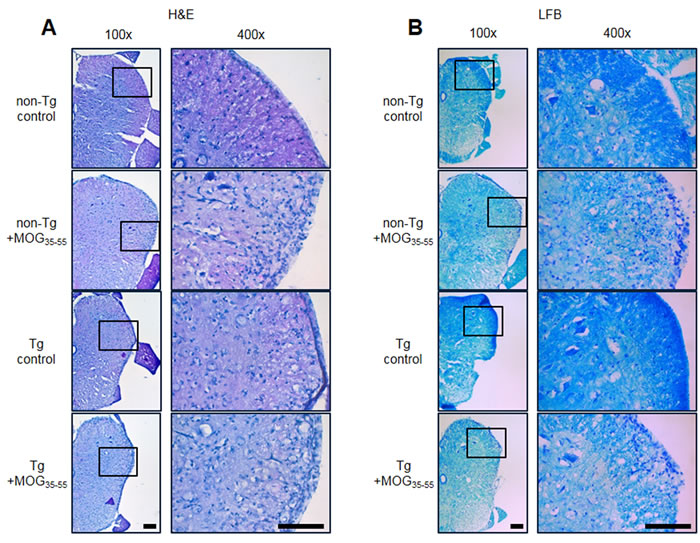 Representative spinal cord histopathology of MOG-induced EAE in non Tg and IL-32&#x3b1; mice.