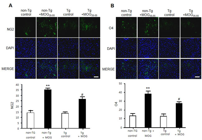 NG2 and O4 expression of MOG-induced EAE in non Tg and IL-32&#x3b1; mice.