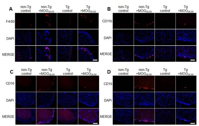 Representative spinal cord immune cell infiltration of MOG-induced EAE in non Tg and IL-32&#x3b1; mice.