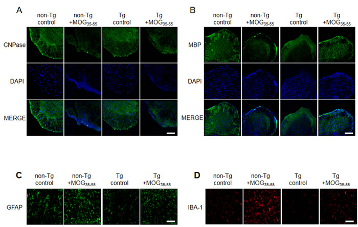 Representative spinal cord myelination related protein, astrocytes and microglia activation levels of MOG-induced EAE in non Tg and IL-32&#x3b1; mice.