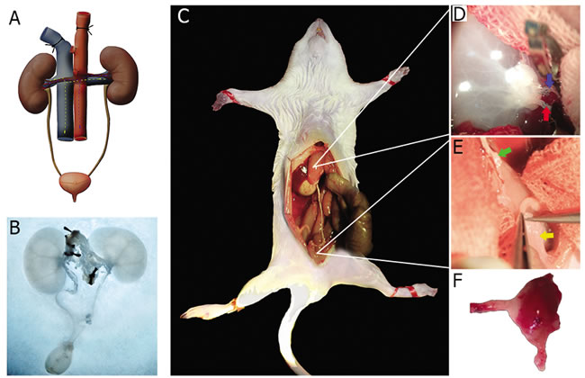 Schema of using autologous bio-reactor to rebuild the left kidney of the decellularized scaffold.