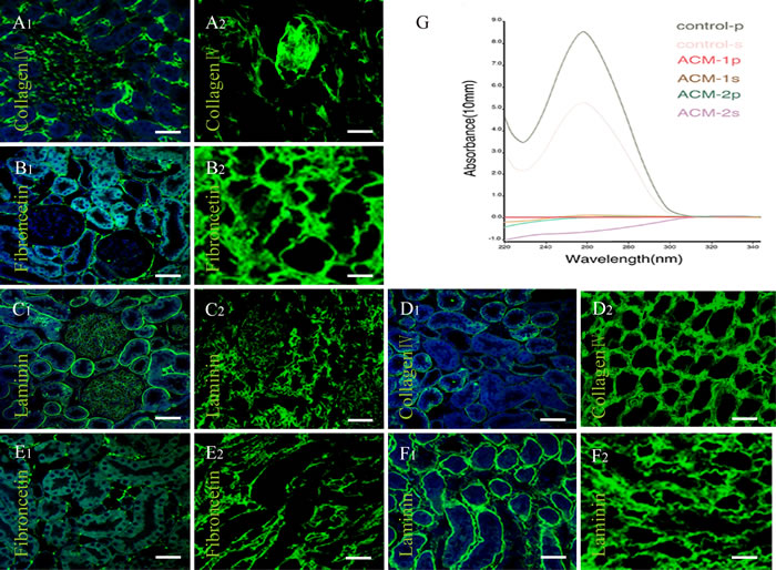DNA analysis and Immunofluorescence of decellularized kidney scaffolds.
