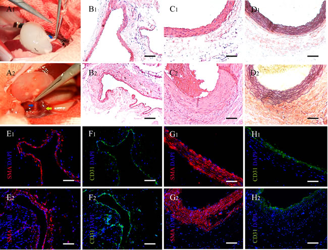 Implantation of acellular kidney and characteristics of renal vessels in the explanted scaffolds.