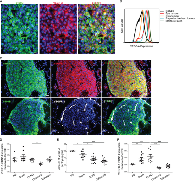 Uveal tumor cells express VEGF-A and VEGFR-1.