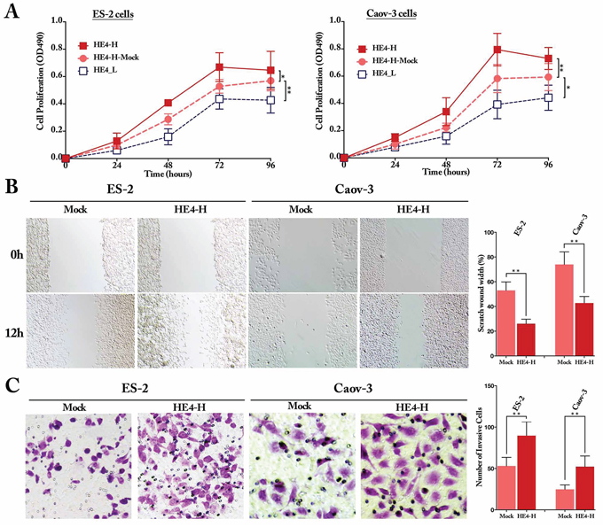 HE4 promoted the proliferation, invasion and metastasis capacities of ovarian cancer cells in vitro.