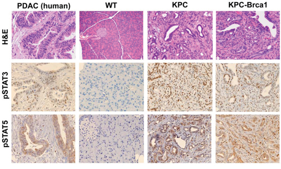 The Jak/STAT signaling pathway is active in genetically engineered mouse models (GEMM) of PDAC.