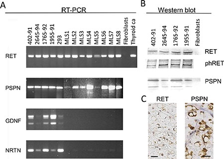 Expression of RET and ligands in MLS cell lines and tissues.