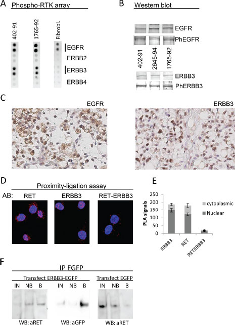 Expression of EGFR and ERBB3 in MLS cell lines and tissues.
