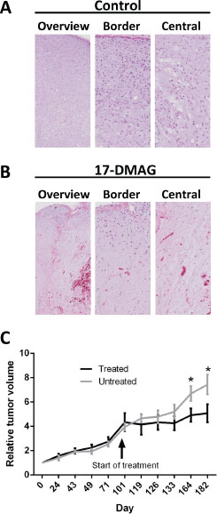 Histology of MLS xenografts from NUDE mice.