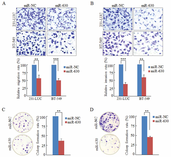 Ectopic expression of miR-630 suppresses Transwell migration, Matrigel invasion and colony formation in breast cancer cells in vitro.