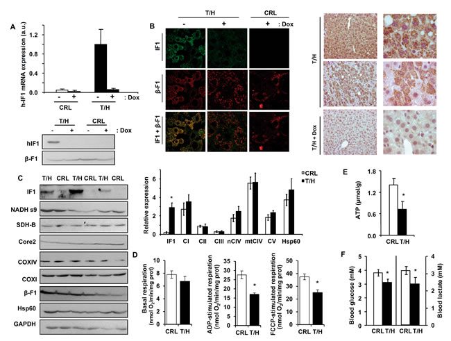 OXPHOS is inhibited in the liver of mice expressing hIF1.
