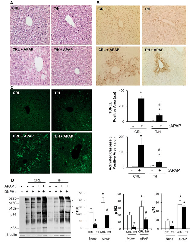 Restraining OXPHOS protects from APAP-induced cell death.