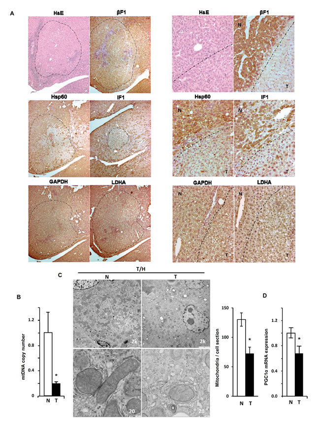 Repression of mitochondrial biogenesis in DEN-induced hepatocarcinogenesis (HCC).