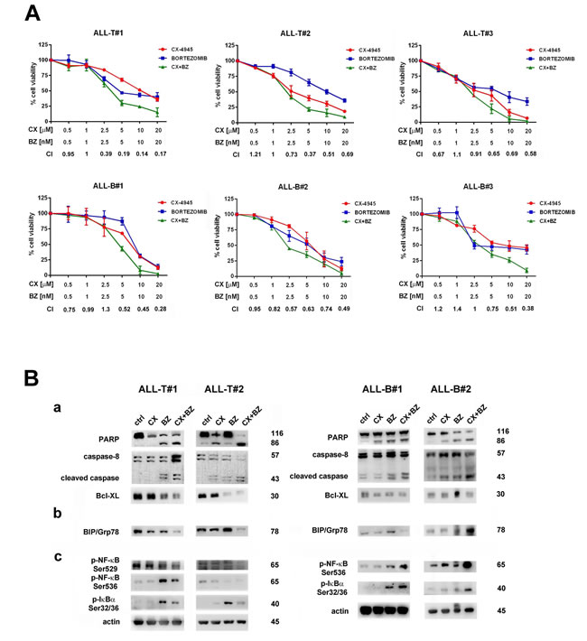 The Bortezomib/CX-4945 combined treatment is cytotoxic to primary lymphoblasts from T- and B-ALL patients, affects ER stress/UPR signaling and activates NF-&#x3ba;B pro-apoptotic functions.
