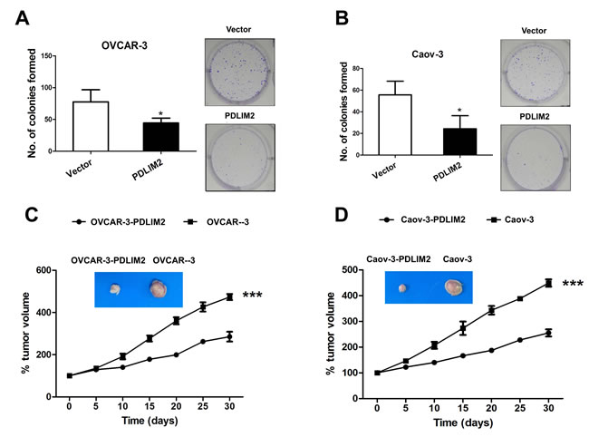 Suppression of tumorigenicities of ovarian cancer cells by PDLIM2.