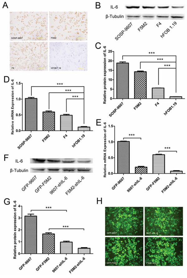 IL-6 expression in osteosarcoma cells and shRNA-mediated suppression.