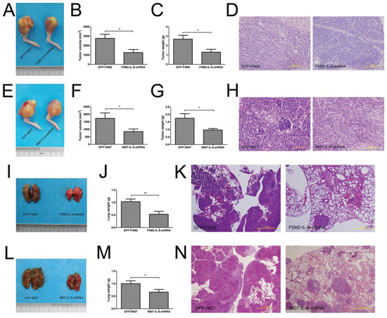 IL-6 shRNA suppresses the growth and metastasis of primary tumours in nude mouse models.