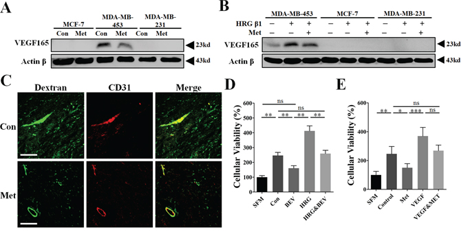 Inhibition of VEGFA signaling was involved in the mechanism of metformin-induced anti-angiogenesis and reduction of vessel leakage.