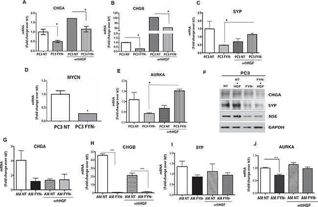 FYN signaling regulates the expression of NE markers in PC3 and ARCaPM cells.