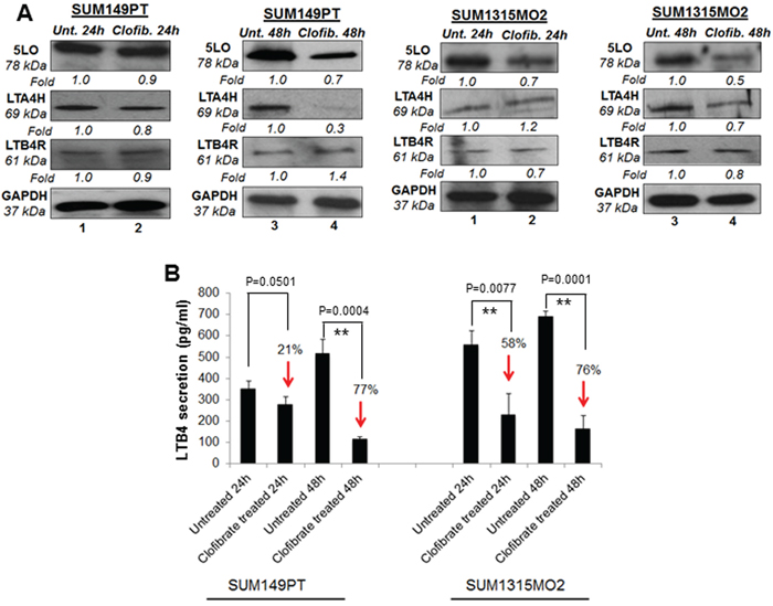 Effect of clofibrate treatment on the 5-lipooxygenase pathway in SUM149PT and SUM1315MO2 cells.