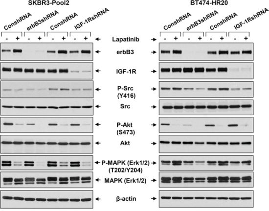 The erbB3 receptor and IGF-1R initiates activation of distinct downstream signaling pathways in trastzumab-resistant breast cancer cells.