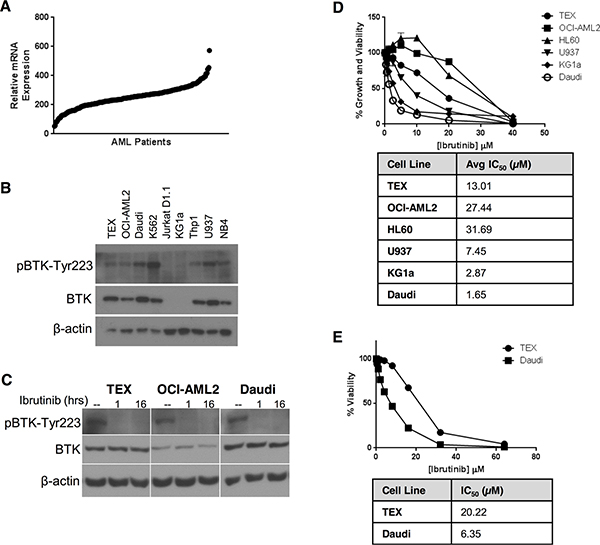 AML cell lines express constitutively active BTK, but are insensitive to ibrutinib.